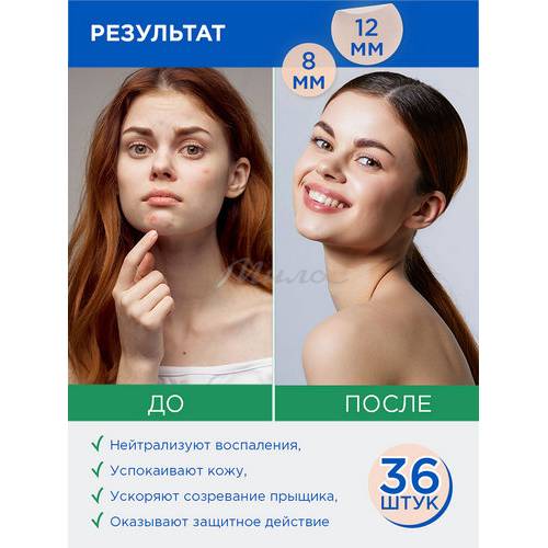 Патчи точечные от прыщей ПРП с чайным деревом и салициловой кислотой, 36 шт. #11
