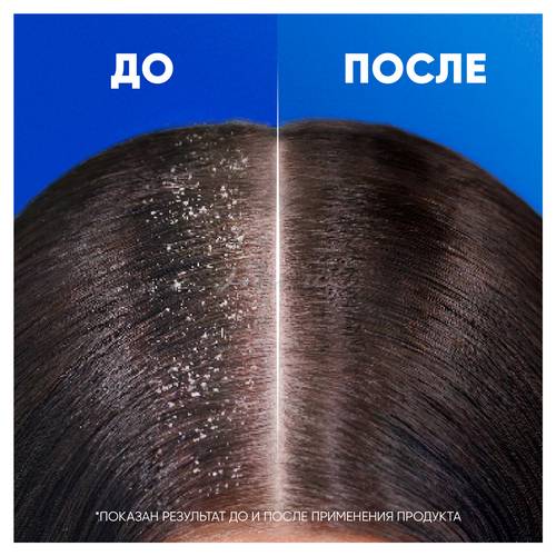 Шампунь против перхоти HEAD & SHOULDERS Ментол, 1000 мл #5